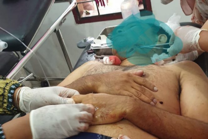 
					Di Padang Lawas, Pemilik Kios HP di Tebas Lehernya Pake Kampak