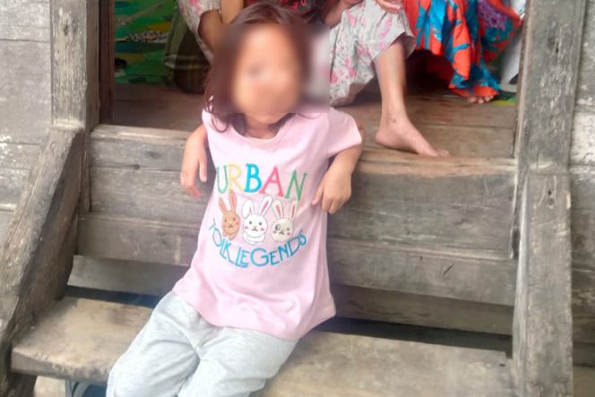 
					Tak Punya Biaya Berobat, Orang Tua Penderita Benjolan Diwajah Warga Simangambat Lorong VII Siabu Mohon Bantuan Dermawan