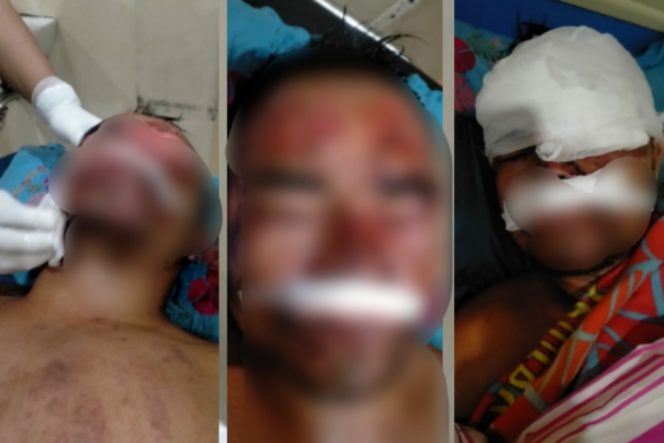 
					Lukas Laia, Warga Sinunukan I Jadi Korban Curas, 1 HP dan Uang 6 Juta Lewong